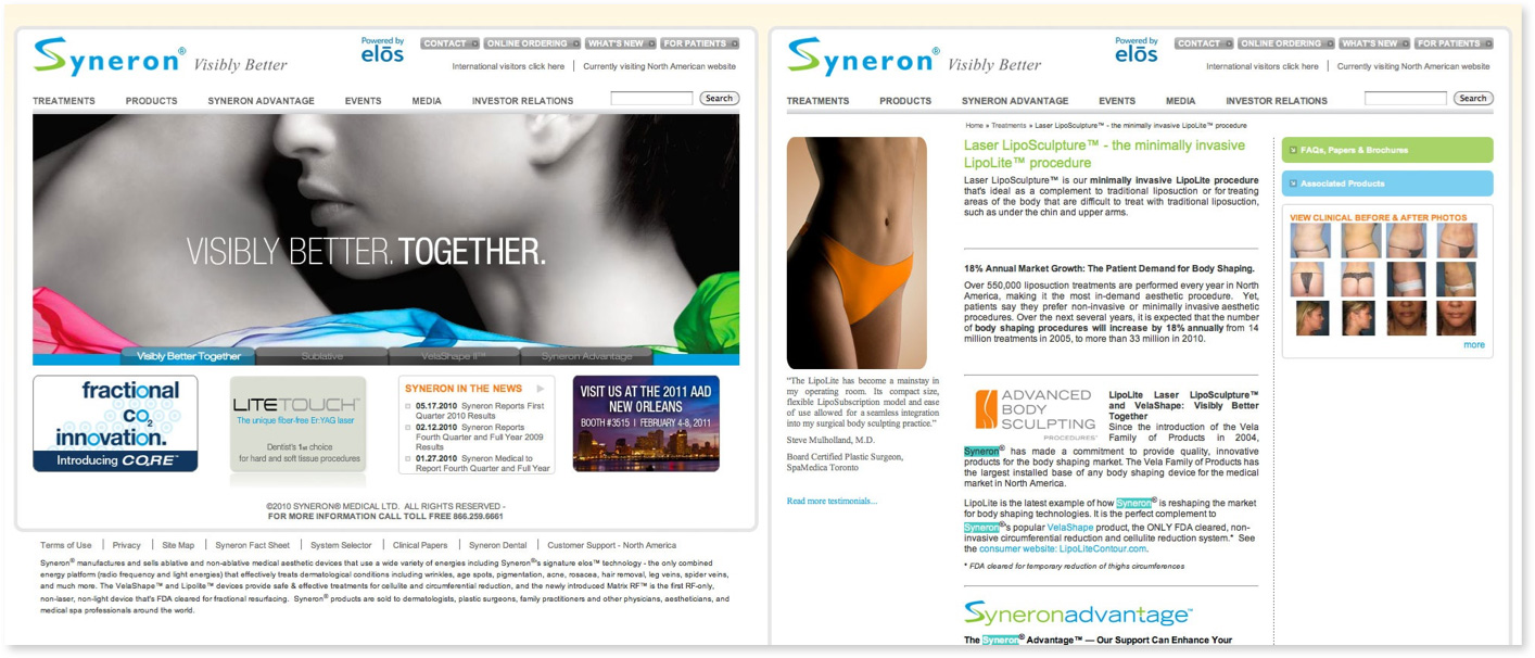 Syneron Company Homepage